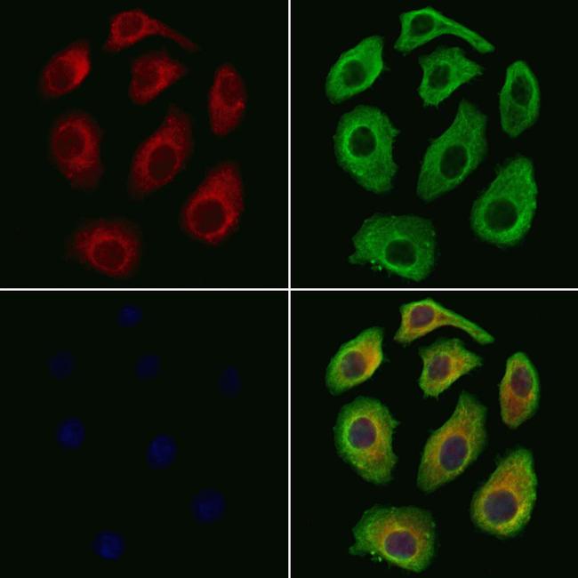 S100A7 Antibody in Immunocytochemistry (ICC/IF)