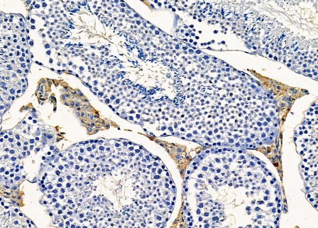 RGPD5 Antibody in Immunohistochemistry (Paraffin) (IHC (P))