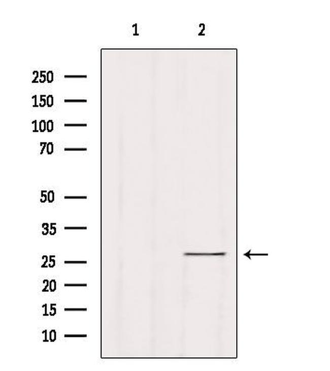 RAB33B Antibody in Western Blot (WB)