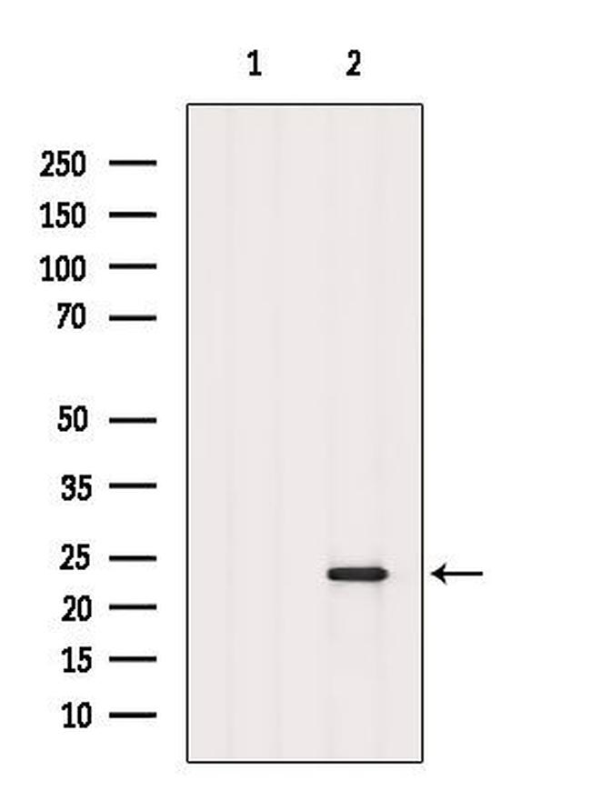 RAB8A Antibody in Western Blot (WB)