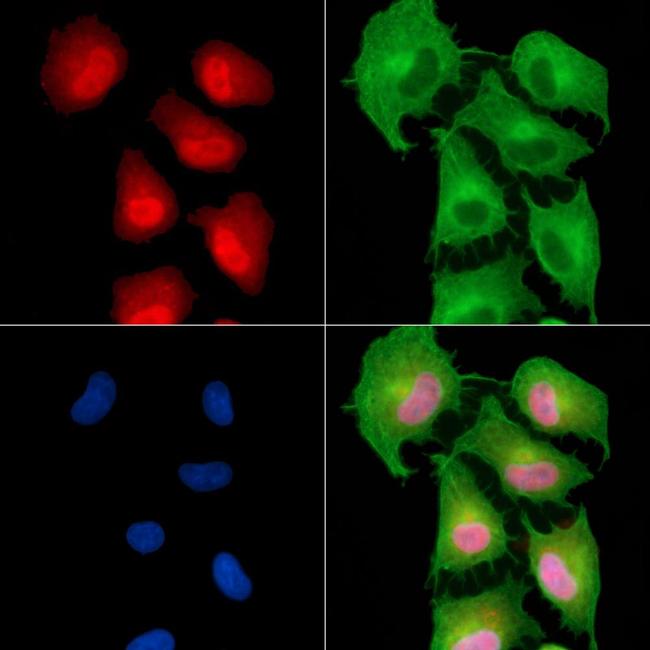 RGS20 Antibody in Immunocytochemistry (ICC/IF)