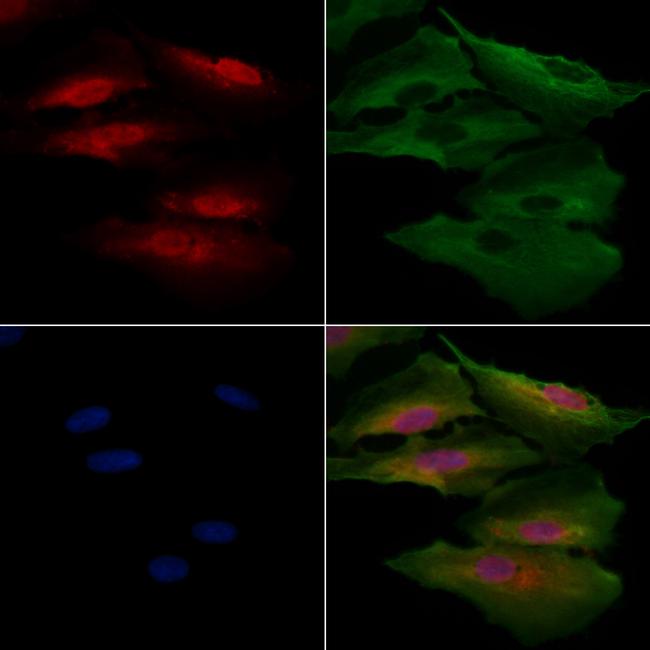 Rhotekin Antibody in Immunocytochemistry (ICC/IF)