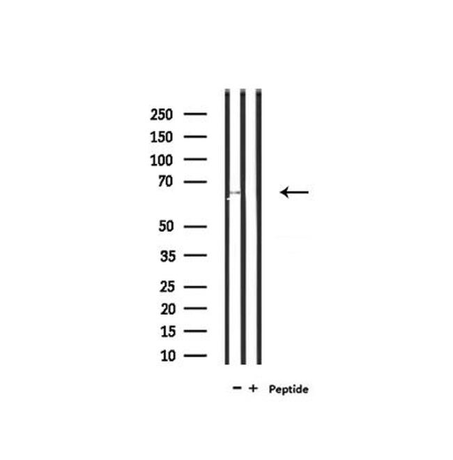 SLC6A20 Antibody in Western Blot (WB)