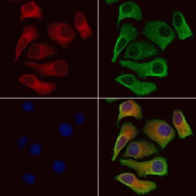 SLC4A7 Antibody in Immunocytochemistry (ICC/IF)