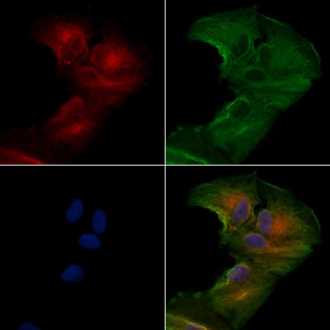 SCN11A Antibody in Immunocytochemistry (ICC/IF)