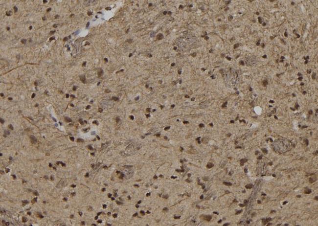 ZNF280B Antibody in Immunohistochemistry (Paraffin) (IHC (P))