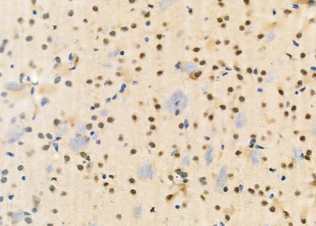 TCEAL2 Antibody in Immunohistochemistry (Paraffin) (IHC (P))