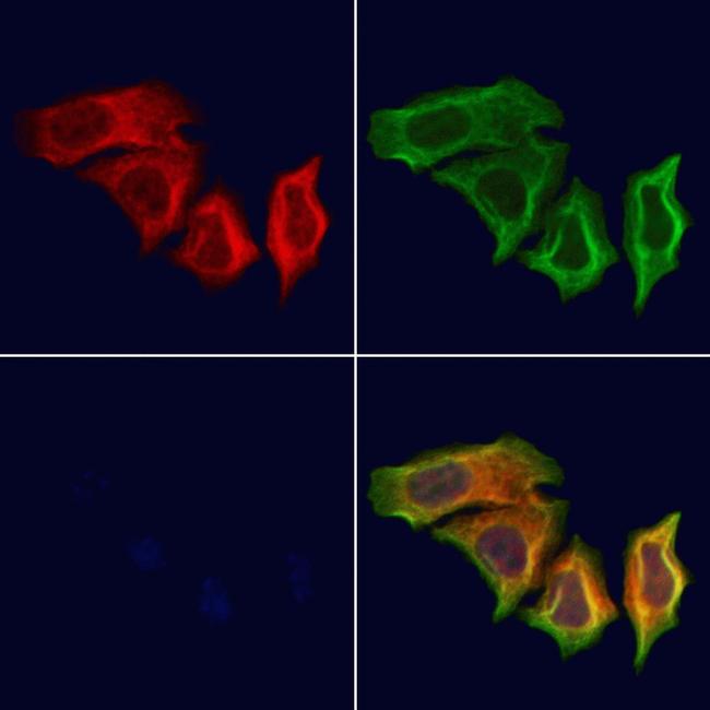 TNNT1 Antibody in Immunocytochemistry (ICC/IF)