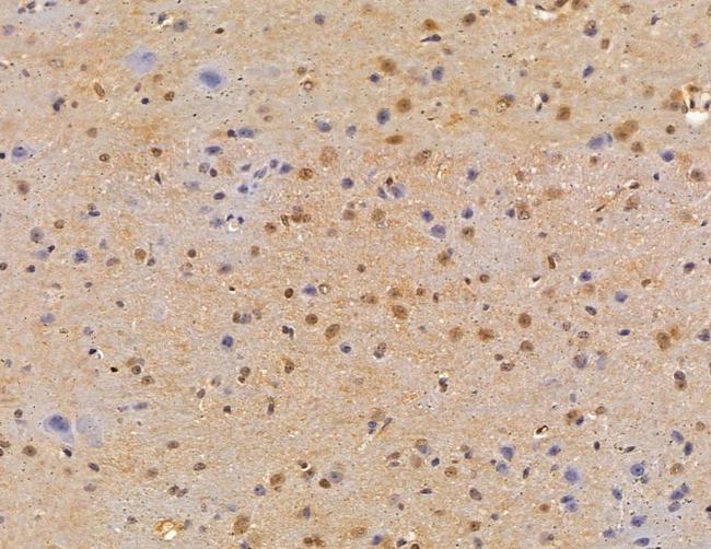 LSM2 Antibody in Immunohistochemistry (Paraffin) (IHC (P))