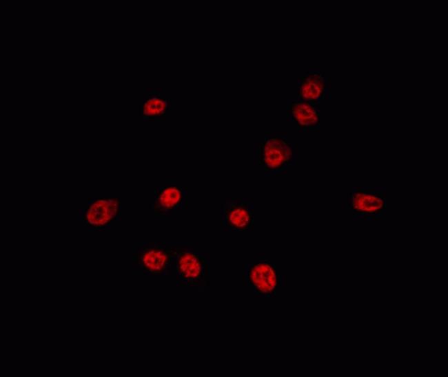 USP16 Antibody in Immunocytochemistry (ICC/IF)