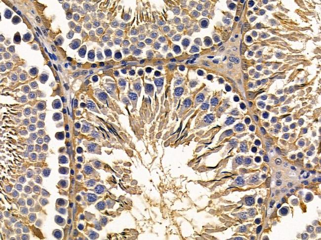 USP6 Antibody in Immunohistochemistry (Paraffin) (IHC (P))