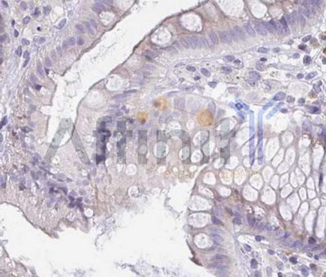 CD178 Antibody in Immunohistochemistry (Paraffin) (IHC (P))