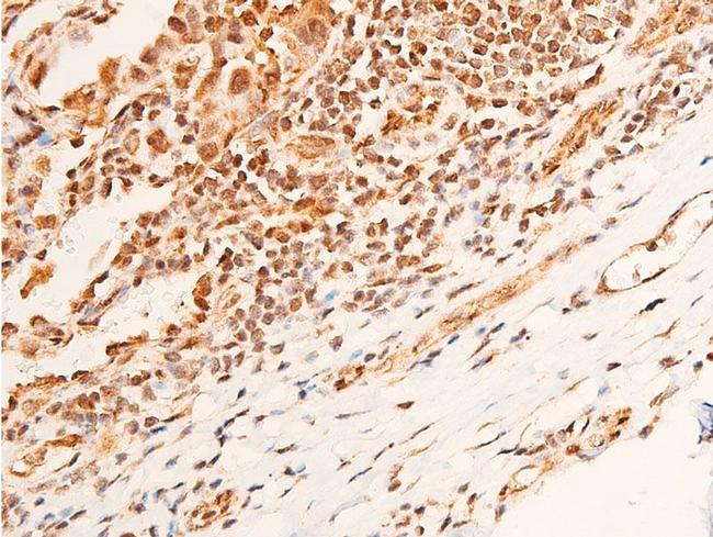 Phospho-Chk1 (Ser296) Antibody in Immunohistochemistry (Paraffin) (IHC (P))