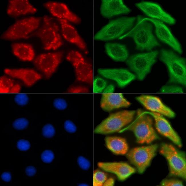 CCS Antibody in Immunocytochemistry (ICC/IF)