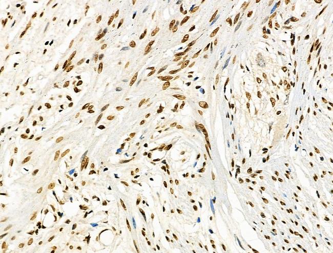 Phospho-CD227 (Mucin 1) (Tyr1229) Antibody in Immunohistochemistry (Paraffin) (IHC (P))