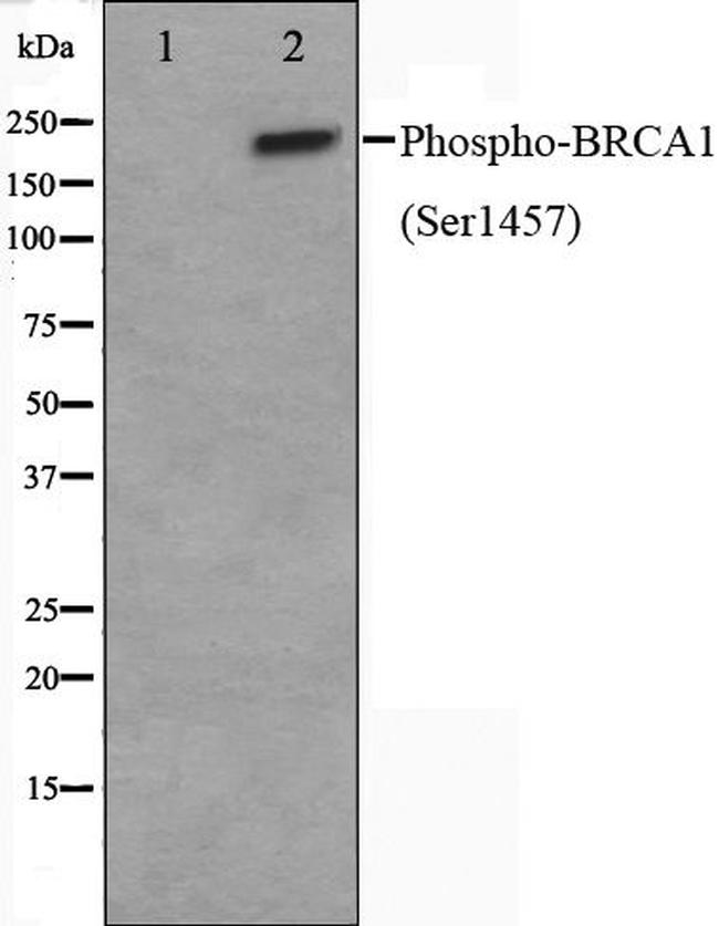 Phospho-BRCA1 (Ser1457) Antibody in Western Blot (WB)