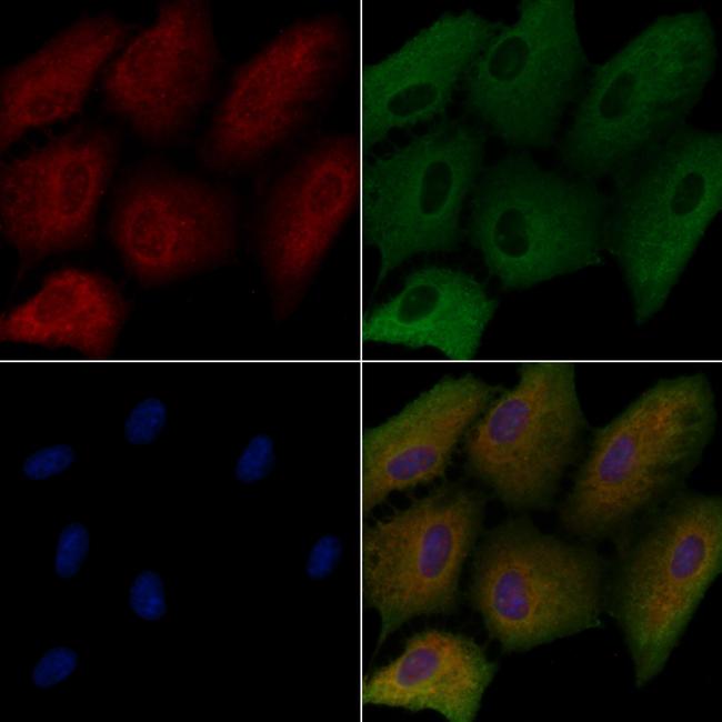 BAK Antibody in Immunocytochemistry (ICC/IF)