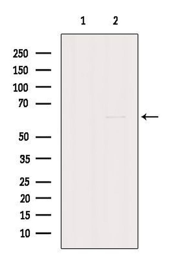 GK2 Antibody in Western Blot (WB)