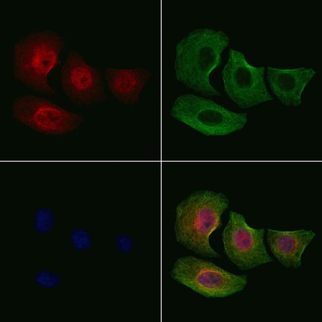 Phospho-Smad3 (Ser208) Antibody in Immunocytochemistry (ICC/IF)