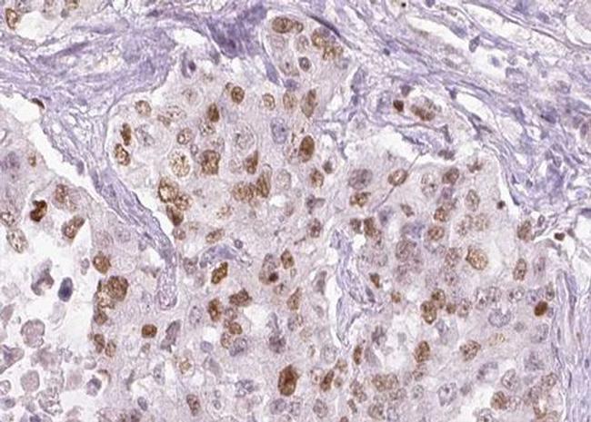 Phospho-ATM (Ser1981) Antibody in Immunohistochemistry (Paraffin) (IHC (P))