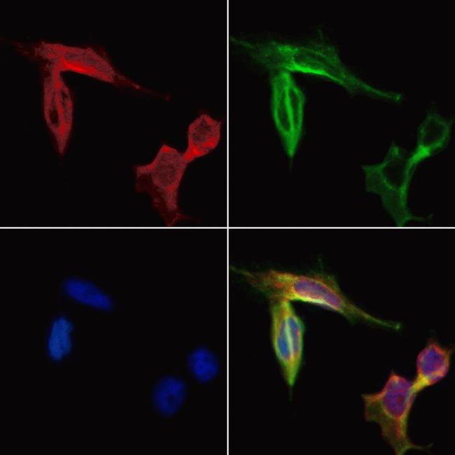 CCR7 Antibody in Immunocytochemistry (ICC/IF)