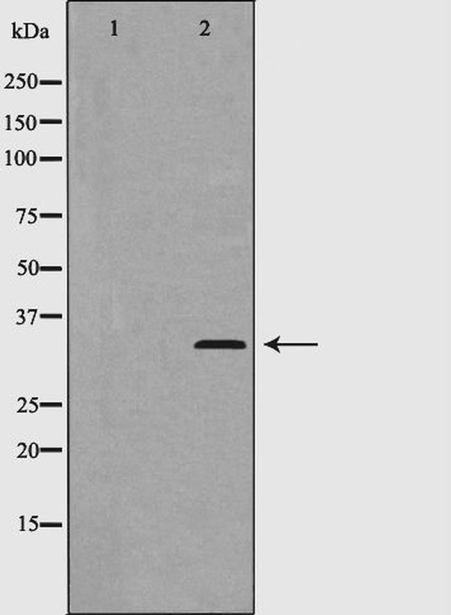 Phospho-Cyclin D2 (Thr280) Antibody in Western Blot (WB)