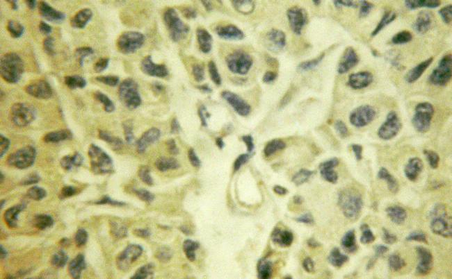 TAK1 Antibody in Immunohistochemistry (Paraffin) (IHC (P))