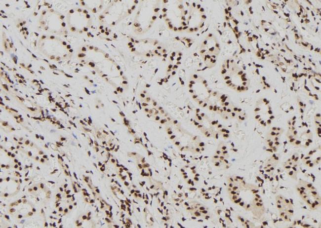 ELP2 Antibody in Immunohistochemistry (Paraffin) (IHC (P))