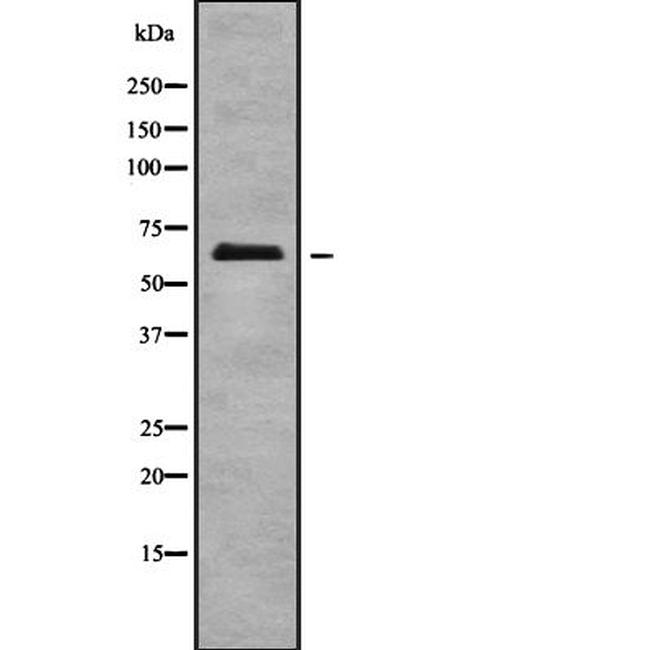 ECM1 Antibody in Western Blot (WB)