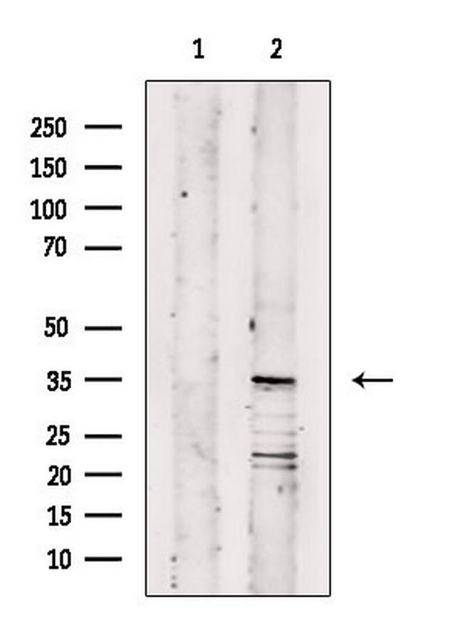 OR11A1 Antibody in Western Blot (WB)