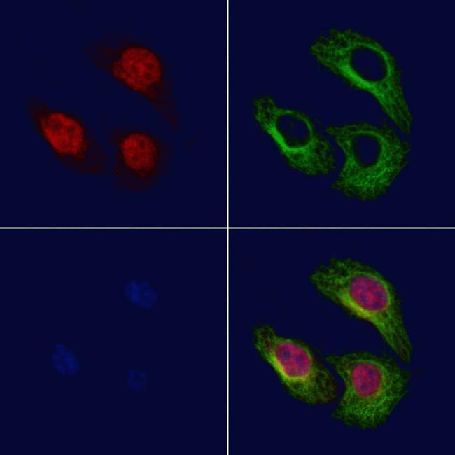 GSDMD Antibody in Immunocytochemistry (ICC/IF)