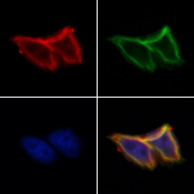 SLC30A3 Antibody in Immunocytochemistry (ICC/IF)