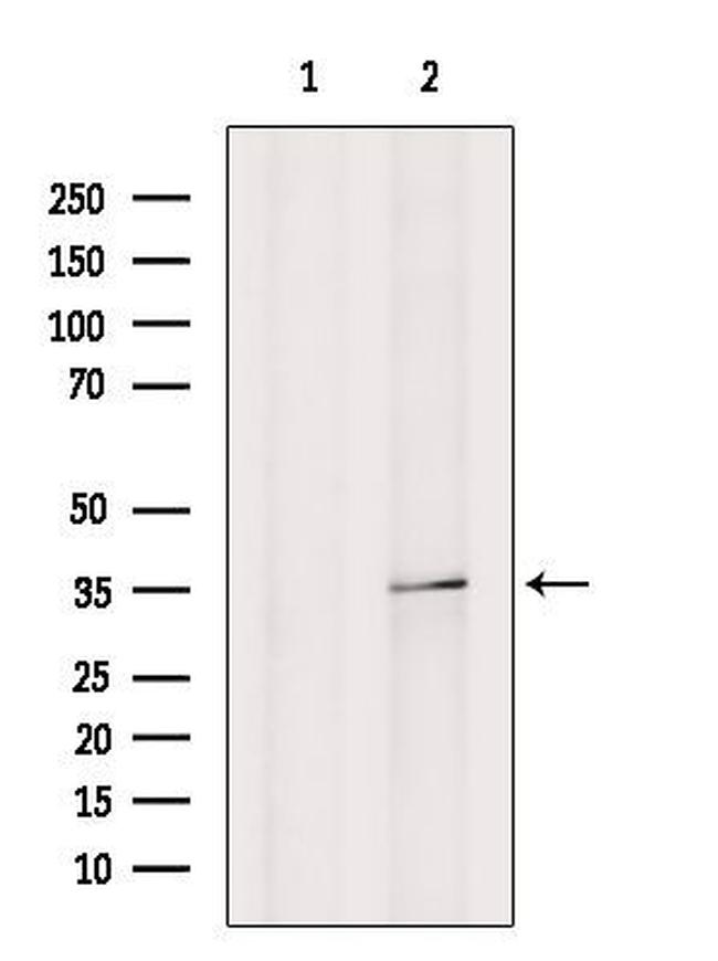 ARPC2 Antibody in Western Blot (WB)