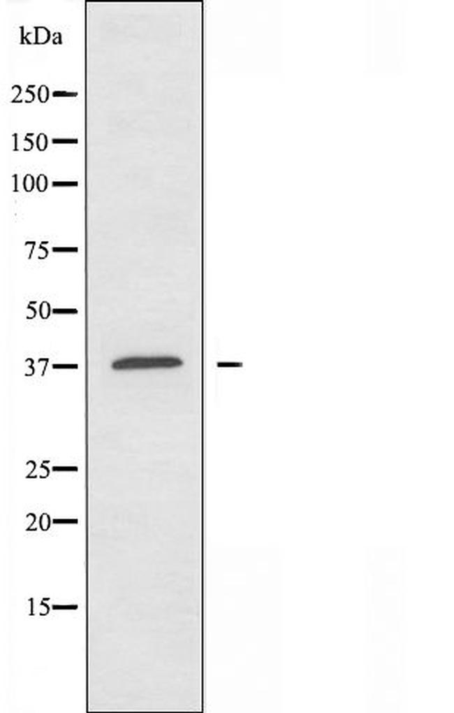 TUSC3 Antibody in Western Blot (WB)