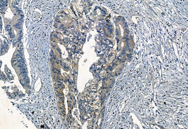 SMO Antibody in Immunohistochemistry (Paraffin) (IHC (P))