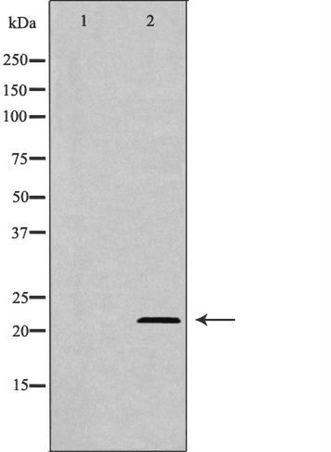 Adenylate Kinase 1 Antibody in Western Blot (WB)