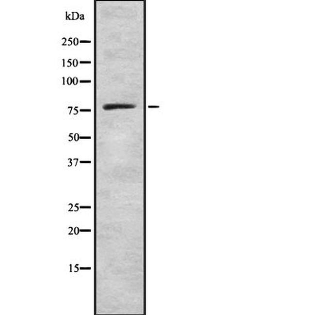 GUCY1A3 Antibody in Western Blot (WB)