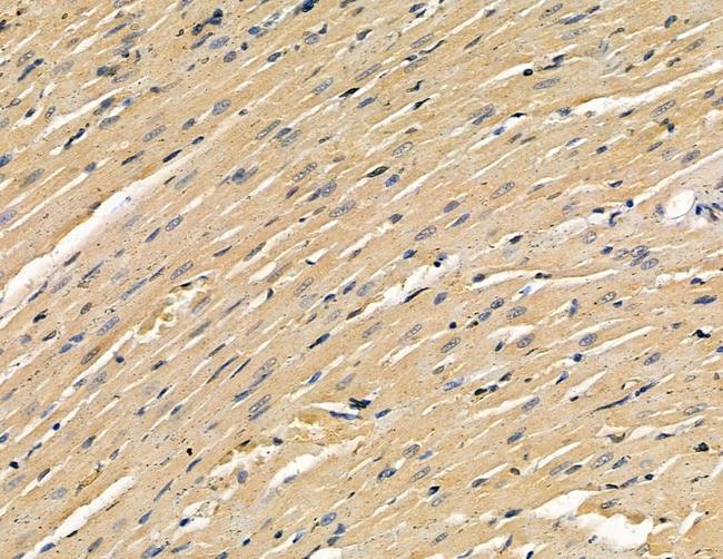 TOP1MT Antibody in Immunohistochemistry (Paraffin) (IHC (P))