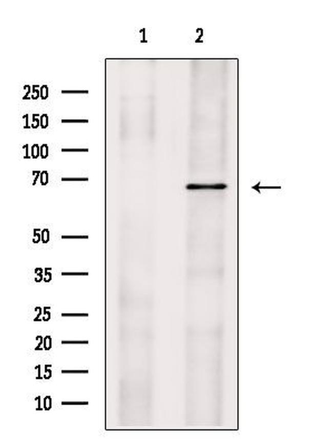 SLC22A4 Antibody in Western Blot (WB)