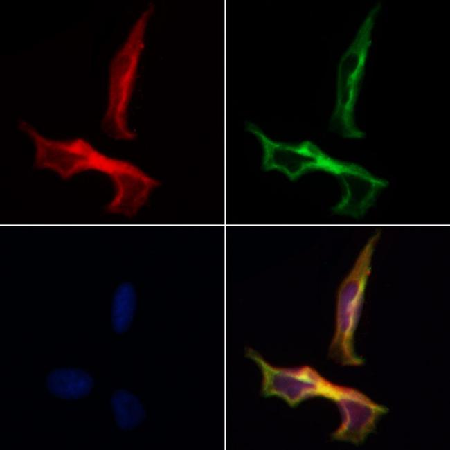 14-3-3 beta/zeta Antibody in Immunocytochemistry (ICC/IF)