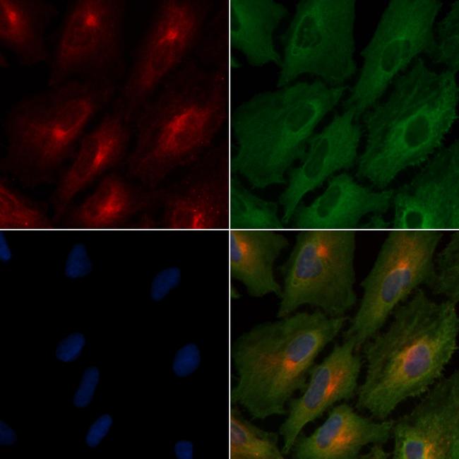 RON Antibody in Immunocytochemistry (ICC/IF)