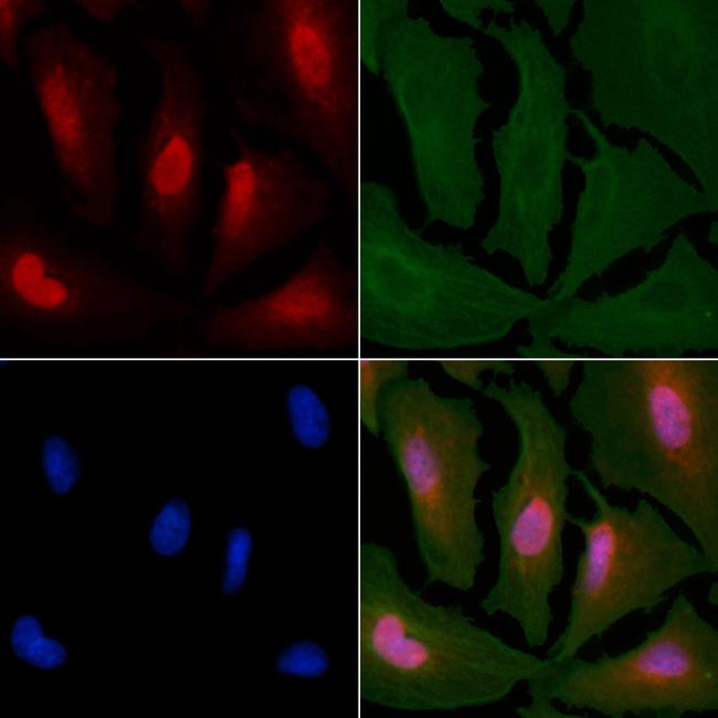 Sodium Channel Pan Antibody in Immunocytochemistry (ICC/IF)