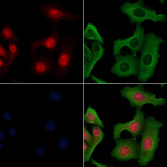 PIAS3 Antibody in Immunocytochemistry (ICC/IF)