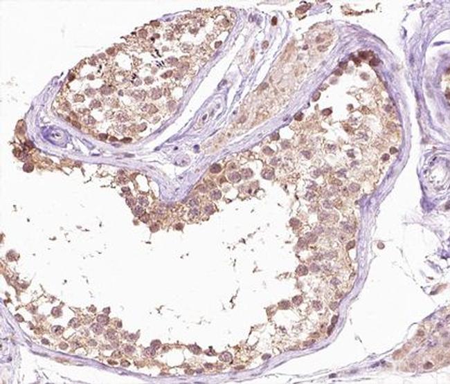 SENP6 Antibody in Immunohistochemistry (Paraffin) (IHC (P))