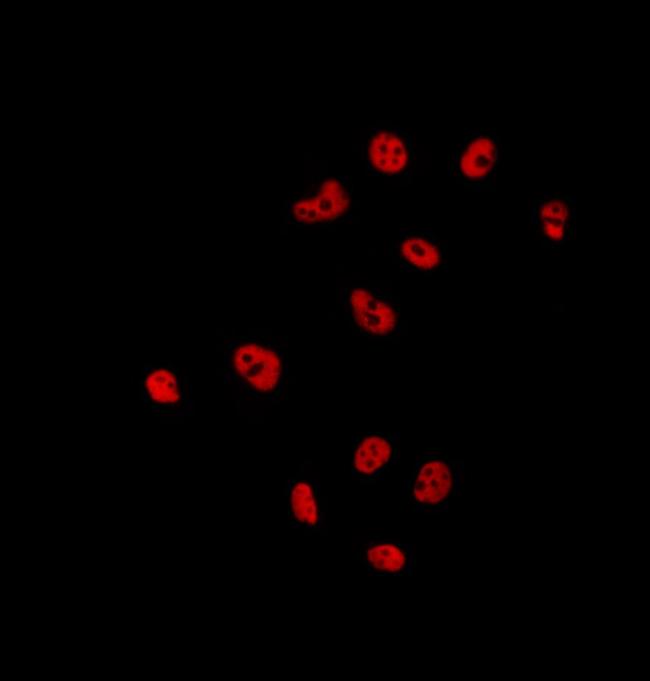 UBA2 Antibody in Immunocytochemistry (ICC/IF)