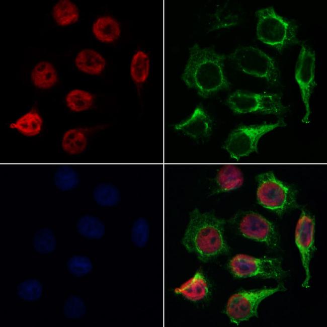 TAF1 Antibody in Immunocytochemistry (ICC/IF)