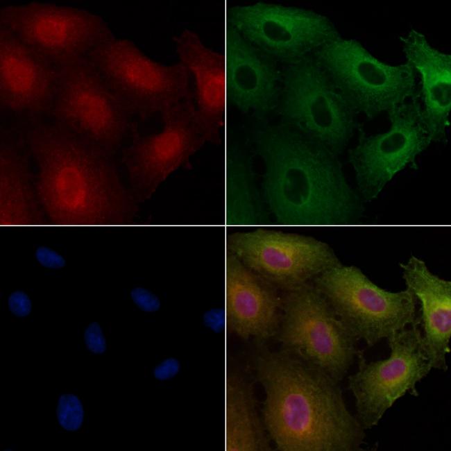 DMC1 Antibody in Immunocytochemistry (ICC/IF)