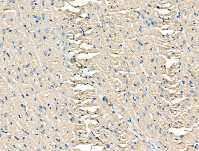 FYCO1 Antibody in Immunohistochemistry (Paraffin) (IHC (P))