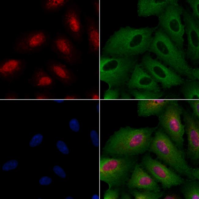 ATRX Antibody in Immunocytochemistry (ICC/IF)