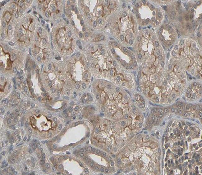 DUS2L Antibody in Immunohistochemistry (Paraffin) (IHC (P))